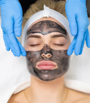 Carbon PhotoFacial Carbon PhotoFacial Laser