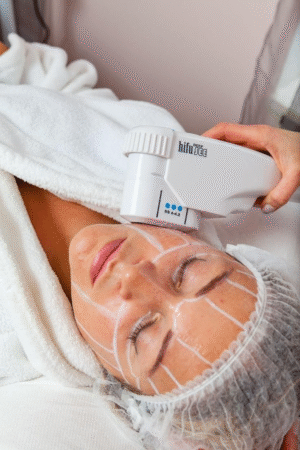YagLaser PhotoFacial YAG Laser Skin Rejuvenation / PhotoFacial