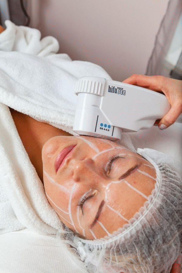 YAG Laser Skin Rejuvenation / PhotoFacial